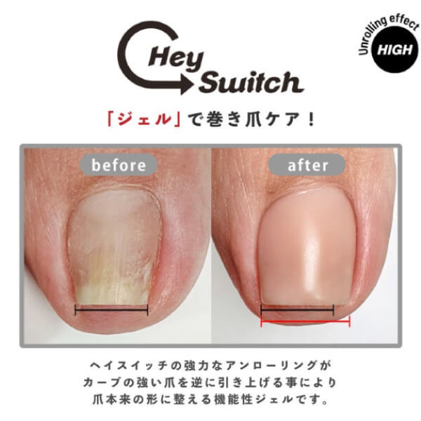 ヘイスイッチ「ジェル」で巻き爪ケア